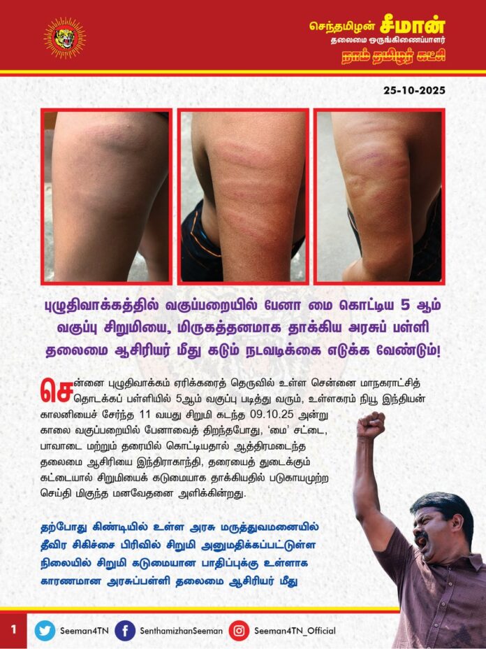 புழுதிவாக்கத்தில் வகுப்பறையில் பேனா மை கொட்டிய 5ஆம் வகுப்பு சிறுமியை, மிருகத்தனமாக தாக்கிய அரசுப்பள்ளி தலைமை ஆசிரியர் மீது கடும் நடவடிக்கை எடுக்க வேண்டும்!
@CMOTamilnadu @mkstalin
சென்னை புழுதிவாக்கம் ஏரிக்கரைத் தெருவில் உள்ள சென்னை மாநகராட்சித் தொடக்கப் பள்ளியில் 5ஆம் வகுப்பு படித்து வரும், உள்ளகரம் நியூ இந்தியன் காலனியைச் சேர்ந்த 11 வயது சிறுமி கடந்த 09.10.25 அன்று காலை வகுப்பறையில் பேனாவைத் திறந்த போது, 'மை' சட்டை, பாவாடை மற்றும் தரையில் கொட்டியதால் ஆத்திரமடைந்த தலைமை ஆசிரியை இந்திராகாந்தி, தரையைத் துடைக்கும் கட்டையால் சிறுமியைக் கடுமையாக தாக்கியதில் படுகாயமுற்ற செய்தி மிகுந்த மனவேதனை அளிக்கின்றது.
தற்போது கிண்டியில் உள்ள அரசு மருத்துவமனையில் தீவிர சிகிச்சை பிரிவில் சிறுமி அனுமதிக்கப்பட்டுள்ள நிலையில் சிறுமி கடுமையான பாதிப்புக்கு உள்ளாக காரணமான அரசுப்பள்ளி தலைமை ஆசிரியர் மீது தமிழ்நாடு காவல்துறை இதுவரை எவ்வித நடவடிக்கையும் எடுக்காதது வன்மையான கண்டனத்துக்குரியது.
அப்பகுதியை சேர்ந்த திமுக வட்டச்செயலாளரும், 186 வது வட்ட மாமன்ற உறுப்பினருமான மணிகண்டன் தலையீடு காரணமாகவே அரசுப்பள்ளி தலைமை ஆசிரியர் மீதும் நடவடிக்கை எடுக்க காவல்துறை தயங்குகிறதா?. அல்லது பாதிக்கப்பட்ட சிறுமி ஆதித்தமிழ்க்குடி என்பதால் காவல்துறை நடவடிக்கை எடுப்பதில் பாகுபாடு காட்டுகிறதா? என்ற அப்பகுதி மக்கள் எழுப்பும் கேள்விகள் மிகமிக நியாயமானதேயாகும்.
சிறுமியின் கடுமையான உடல்நலப்பாதிப்பு குறித்த புகாரை ஏற்க மறுத்து, இதுவரை வழக்கு பதியாதது ஏன் என்ற கேள்விக்கு தமிழ்நாடு அரசு என்ன பதில் கூறப்போகிறது? திமுக ஆட்சியில் ஏழை எளிய மக்கள் என்றால் ஒரு நீதி? அதிகாரம் மிக்கவர்கள், வசதி படைத்தவர்கள் என்றால் வேறு நீதியா? இதுதான் திராவிட மாடல் கட்டிக்காத்த சமூகநீதியா? பெற்றுத்தந்த சமத்துவமா? வெட்கக்கேடு!
ஆகவே, சென்னை புழுதிவாக்கத்தில் 5 ஆம் வகுப்பு சிறுமியை, மிருகத்தனமாக தாக்கிய அரசுப்பள்ளி தலைமை ஆசிரியர் மீது உடனடியாக வழக்கு பதிந்து கடும் சட்ட நடவடிக்கை எடுக்க வேண்டுமென வலியுறுத்துகிறேன்.
- செந்தமிழன் சீமான்
தலைமை ஒருங்கிணைப்பாளர்
நாம் தமிழர் கட்சி